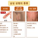 하이닥터 비뇨의학과 의원 | 울산 비뇨기과 남자 성병 정밀 검사- 하이닥터비뇨의학과