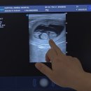 해피올동물병원 | “우리 로또 임신 확인! 2026.01.10 교배 후 4마리… 강아지 임신 관리 &amp; 출산 준비 총정리”