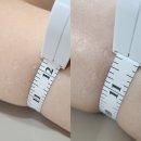 [김해 대청동] &#39;샤이나 뷰티&#39; 김해 팔뚝 관리 김해 테라노바 솔직 후기