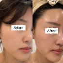 하로스파 이미지