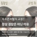 참예쁜 e 치과의원 | [문정법조타운 치과] "무조건 비발치로 해주세요?" 무리한 덧니 교정이 '돌출입'을 만드는 이유