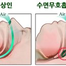 우리들이비인후과 네이버블로그