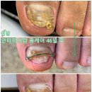 타임네일 페디베네 네이버블로그