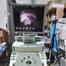 BK Pro Focus Portable Ultrasound System 이미지