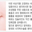 FAQ.볼에 살이없고 입이 돌출입이라 고민입니다./돌출입-돌출입교정/돌출입교정후 포인트 이미지