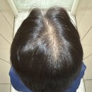 이슬아로마 | 대치동미용실ㅣ무이한티점 이슬 수석디자이너 아윤채 두피케어 대만족!