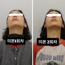 미본샵 | 논현동 얼굴윤곽관리 미본 강남점 얼굴비대칭 골반비대칭관리 2회차 후기