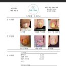 타임네일 페디베네 이미지