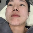 닥터고운선의원 | 닥터고운선의원 인모드 포마 후기