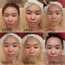 [청담 피부관리] 청담동 피부관리 박수정청담뷰티센터인스티튜트 :: 산소테라피