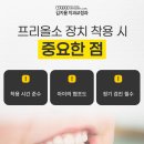 김지용치과의원 | 대구어린이교정치과 어린이 예방교정 프리올소