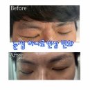 엘도라샵 | [수성구 남자 눈썹 왁싱] 두산동 엘도라샵 후기, 인상 확 달라지는 전후 공개