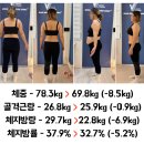 수지척추체형교정