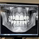 맘편한치과의원 | 으아아, 내 치아 지켜! 드디어 맘 편한 치과 찾았어요
