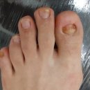 레푸스 앤 두두네일 이미지