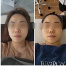 [포항 피부관리] 비비뽀얀에서 즉각적인 피부톤 화사하게! 비비글로우 관리 후기!