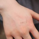블루스팟 이미지