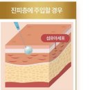 (주)제이시스메디칼 | 펀드 스터디 2주차(24.09.19) / 미용의료기기, 파마리서치, 세방전지
