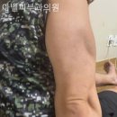 아벨피부과의원 네이버블로그