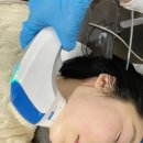 안산리프팅 맛집 내돈내산 볼뉴머, 슈링크유니버스 리프팅후기! (팔자주름&amp;이중턱살 효과, 통증, 다운타임)