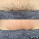씨유창원대동훼미리점 | 창원 남자 브라질리언왁싱 후기｜통증 어느 정도? 남자원장 시술 차이 직접 받아본 결과