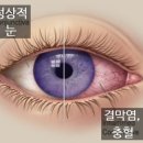 비엔나안경 이미지