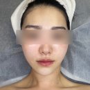 성샤인 | 부산 당감동피부관리 미샤인뷰티 디톡스 수분관리 후기! 전후