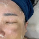 에스제이(SJ) | 웨딩촬영 다음날, 송탄피부관리 받고 온 “SJ에스제이 파메스테틱 피부연구소” 후기