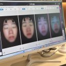 댄의원 | 의정부 피부과 솔직후기 : 모어댄의원 피코토닝 1회 관리