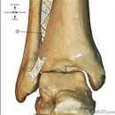 연세올찬재활의학과의원 | 발목 골절로 인한 수술후 재활치료(Ankle Fx-post op Rehabilitation)- 오류동 재활의학과, 정형외과
