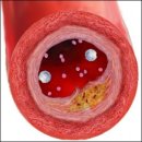 금호키토산 이미지
