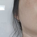 아르페 | 아르페 기미패치 후기 | 붙이고 자는 마이크로니들패치로 간편한 기미·잡티 케어