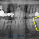 서울식플란트치과의원 이미지