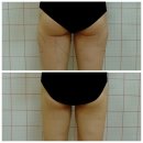 닥터정앤박날씬의원 이미지