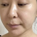 앤비유통 | 마리앤비 트라넥사믹산 5% TNA5 세럼으로 잡티, 톤관리 2주 후기