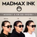 헤어라인 이미지