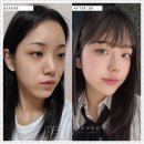 강남세련성형외과의원 이미지