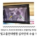 [전라권/광주] 전방십자인대 / 측부인대 완전파열 빛고을 전남대학교 병원 수술기록 1
