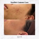 늘빛 | 김해 여드름 관리 전문 늘빛뷰티, 예민 피부로 인한 트러블 관리