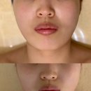 이부진피부관리