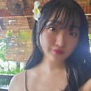 달.사.해. | 자연유착 쌍수 두 달 차 후기: 무쌍 비교 사진, 붓기, 멍 정보