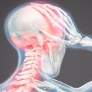 뉴텍컴퓨터 | [송촌동 헬스장, 송촌동 PT]-편두통 원인, 목근육 때문일 수도 있습니다!