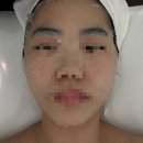 플랜타스페이스디자인 | 대전신부관리 페이스디자인 리프팅 윤곽관리맛집 ‘무아 에스테틱‘