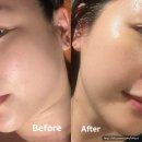 청담피트니스 | 청담 뷰티블르바드ㅣ안면홍조관리 후기ㅣ연예인관리 강남피부관리 추천