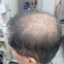 두피 고민은 그만! 연신내 큐사랑에서 천연미네랄염색 받고 두피까지 살아난 후기