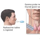Radioactive. 이미지