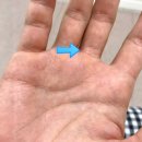 오스정형외과의원 | 원주 정형외과 잘하는곳 : 단계동 오스정형외과 일요일도 정상진료O 손가락물혹진료후기