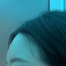 더채움약국 | 내돈내산 이마 필러 후기 | 국산 더채움 프리미엄 솔직 후기 (가격/효과/부작용 총정리)