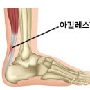 아킬레스