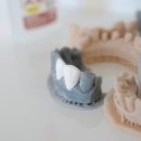 예스치과기공소 이미지